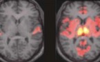 Descubren por qué algunos ruidos nos despiertan mientras dormimos