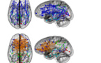 Las estructuras de las conexiones cerebrales de hombres y mujeres son muy distintas