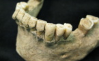 Descubren un “yacimiento” microbiano en dientes humanos de 1.000 años