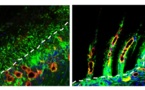 Crean un implante biodegradable que estimula la regeneración de tejido cerebral