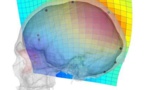 La evolución del cráneo humano ha propiciado problemas visuales y neurológicos