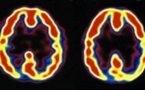 La neuroteología investiga la creación inducida de experiencias místicas