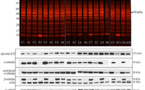 Identifican los daños producidos por el alcohol en el cerebro  a nivel molecular