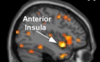 Las personas altamente sensibles tienen un cerebro más reactivo