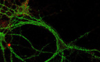 La pérdida de colesterol cerebral podría  explicar el Alzheimer