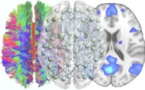 La teoría de redes complejas se enfrenta al problema del cerebro