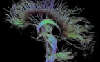 ¿Por qué Internet debería imitar al cerebro, y la economía a la naturaleza?