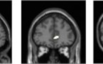 Los dispositivos multimedia podrían estar reduciendo nuestra materia gris