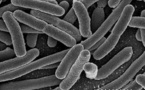 Consiguen neutralizar bacterias sin usar antibióticos: con nanopartículas    