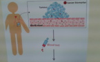 Nanosensores biológicos para la detección precoz del cáncer