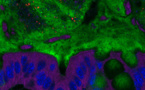 Dos emulsionantes muy comunes alteran la microbiota intestinal de los ratones