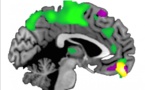 Rasgos del cerebro de las personas más confiadas 