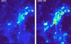 Nanopartículas calentadas con campos magnéticos estimulan el cerebro sin cables