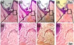 Convierten teléfonos móviles en microscopios por solo tres centavos