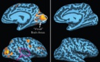 Ver a través de los oídos: la ecolocación implica las áreas cerebrales de la visión