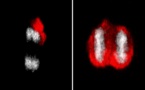 Las células madre pueden crear una barrera contra el envejecimiento cerebral