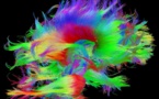 El estilo de vida queda reflejado en las conexiones cerebrales