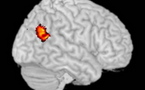 Determinan el área del cerebro que se activa cuando juzgamos a los demás